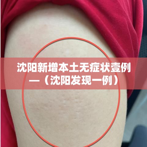 沈阳新增本土无症状壹例—（沈阳发现一例）
