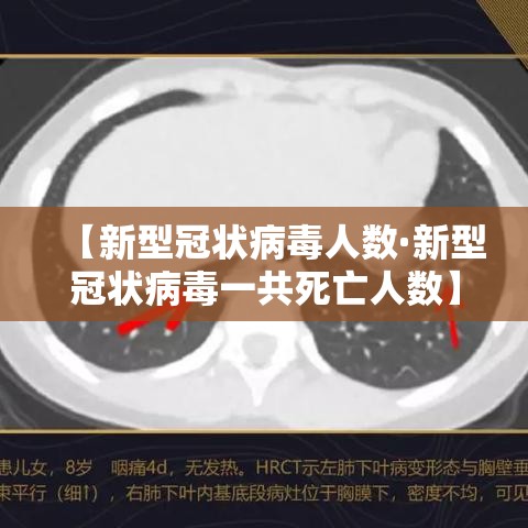 【新型冠状病毒人数·新型冠状病毒一共死亡人数】 【新型冠状病毒人数·新型冠状病毒一共死亡人数】